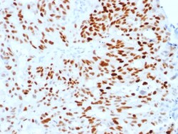 Biotium&nbsp;Estrogen Receptor, alpha (Marker of Estrogen Dependence)(ESR1/1904), Biotin conjugate, 0.1mg/mL