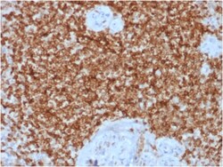 Biotium&nbsp;Bcl-2 (Apoptosis & Follicular Lymphoma Marker) (BCL2/1878R), CF594 conjugate, 0.1mg/mL