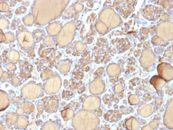 Biotium&nbsp;Thyroglobulin (Thyroidal Cell Marker) (r6E1), CF594 conjugate, 0.1mg/mL