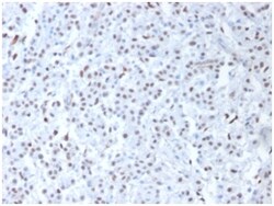 Biotium&nbsp;Wilm's Tumor 1 (WT1) (Wilm's Tumor & Mesothelial Marker), Biotin conjugate, 0.1mg/mL