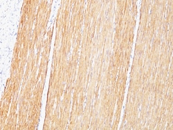Biotium&nbsp;Desmin (Muscle Cell Marker)(D33), CF594 conjugate, 0.1mg/mL