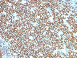 Biotium&nbsp;CD20 / MS4A1 (B-Cell Marker) (rIGEL/773), CF740 conjugate, 0.1mg/mL