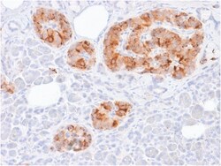 Biotium&nbsp;Chromogranin A / CHGA (Neuroendocrine Marker) (rCHGA/413), CF568 conjugate, 0.1mg/mL