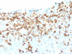 Biotium&nbsp;NGF-Receptor (p75) / CD271 (Soft Tissue Tumor Marker) (NGFR/1964), CF740 conjugate, 0.1mg/mL