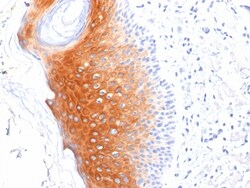 Biotium&nbsp;Cytokeratin 1 (Suprabasal Keratinocyte Marker)(LHK1), CF647 conjugate, 0.1mg/mL
