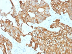 Biotium&nbsp;Cytokeratin 19 (Pancreatic Stem Cell Marker) (rKRT19/800), CF594 conjugate, 0.1mg/mL