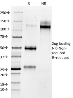 Biotium&nbsp;MMP3 (Marker of Metastasis and Rheumatoid Arthritis)(1B4), CF647 conjugate, 0.1mg/mL
