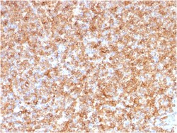 Biotium&nbsp;HLA-DP/-DQ/-DR (MHC II)(CR3/43), CF568 conjugate, 0.1mg/mL