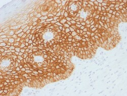 Biotium&nbsp;CD44v4 (Marker of Tumor Metastasis), CF594 conjugate, 0.1mg/mL