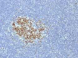 Biotium&nbsp;Bcl-6 (Follicular Lymphoma Marker) (BCL6/1718), CF568 conjugate, 0.1mg/mL