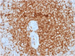 Biotium&nbsp;Bcl-2 (Apoptosis & Follicular Lymphoma Marker) (rBCL2/796), CF568 conjugate, 0.1mg/mL