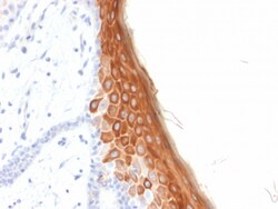 Biotium&nbsp;Cytokeratin 10 (KRT10) (Suprabasal Epithelial Marker) (rKRT10/844), CF568 conjugate, 0.1mg/mL