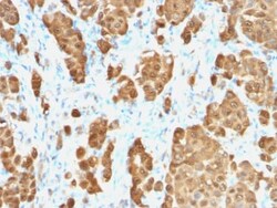 Biotium&nbsp;S100B (Astrocyte and Melanoma Marker) (S100B/1706R), 0.2mg/mL