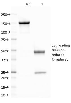 Biotium&nbsp;CELA3B / ELA3B (Pancreatic Function Marker)(CELA3B/1758), 0.2mg/mL
