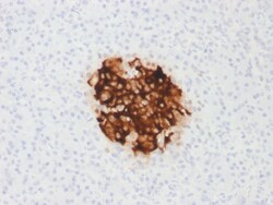 Biotium&nbsp;Insulin / IRDN (beta-Cell & Insulinoma Marker) (rIRDN/805), CF594 conjugate, 0.1mg/mL