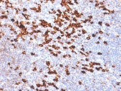 Biotium&nbsp;Human Kappa Light Chain (B-Cell Marker) (IGKC/1999R), CF594 conjugate, 0.1mg/mL