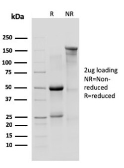Biotium&nbsp;IL-10R1, Mouse (Interleukin-10 Receptor 1) (CD210)(1B1.3a), CF640R conjugate, 0.1mg/mL