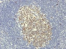 Biotium&nbsp;Bcl-6 (Follicular Lymphoma Marker) (BCL6/1951R), CF594 conjugate, 0.1mg/mL