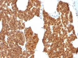 Biotium&nbsp;Parathyroid Hormone (PTH) (N-Terminal), CF488A conjugate, 0.1mg/mL