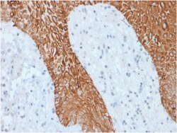 Biotium&nbsp;Cytokeratin, Multi (Epithelial Marker)(KRT/1877R), CF568 conjugate, 0.1mg/mL