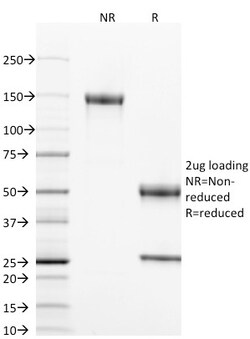Biotium&nbsp;CD40 / TNFRSF5 / CD40L-Receptor(T8P2G4*A6), CF594 conjugate, 0.1mg/mL