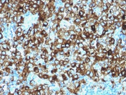 Biotium&nbsp;gp100 / Melanosome / PMEL17 / SILV (Melanoma Marker)(N/A), 0.2mg/mL