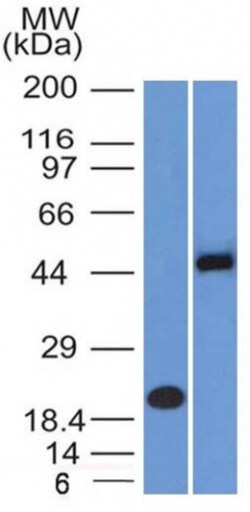 Biotium&nbsp;PAX8 (Renal Cell Marker)(PAX8/1491 + PAX8/1492), CF740 conjugate, 0.1mg/mL