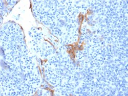 Biotium&nbsp;Cytokeratin 16 (KRT16) (Suprabasal Keratinocyte Marker)(LL025), CF740 conjugate, 0.1mg/mL