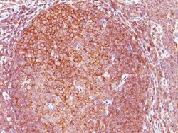 Biotium&nbsp;BCL10 (MALT-Lymphoma Marker)(151), CF647 conjugate, 0.1mg/mL