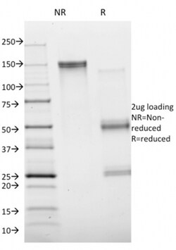 Biotium&nbsp;Annexin A1 / (Hairy Cell Leukemia Marker)(ANXA1/1672), 0.2mg/mL