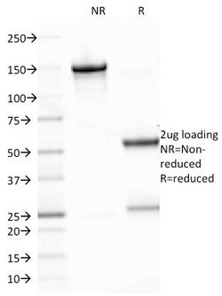Biotium&nbsp;Epstein-Barr Virus (LMP-1)(CS2), 0.2mg/mL