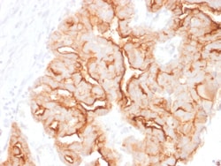 Biotium&nbsp;MUC16 / CA125 (Ovarian Carcinoma Marker)(MUC16/1860), CF594 conjugate, 0.1mg/mL
