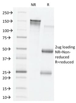 Biotium&nbsp;VEGF (Vascular Endothelial Growth Factor)(VG76e), CF594 conjugate, 0.1mg/mL