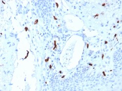 Biotium&nbsp;Tryptase (Mast Cell Marker)(TPSAB1/1961), 1mg/mL