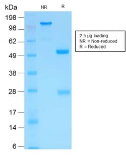 Biotium&nbsp;MMP3 (Marker of Metastasis and Rheumatoid Arthritis)(MMP3/1994R), CF640R conjugate, 0.1mg/mL