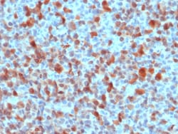 Biotium&nbsp;S100B (Astrocyte and Melanoma Marker), 0.2mg/mL