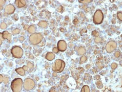 Biotium&nbsp;Thyroglobulin (Thyroidal Cell Marker) (TGB/1970R), Biotin conjugate, 0.1mg/mL