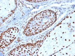 Biotium&nbsp;Nucleophosmin (Acute Myeloid Leukemia Marker)(NPM1/1902), 1mg/mL