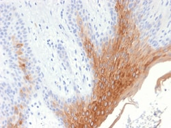 Biotium&nbsp;Cytokeratin 10 (KRT10) (Suprabasal Epithelial Marker) (KRT10/1990R), CF647 conjugate, 0.1mg/mL
