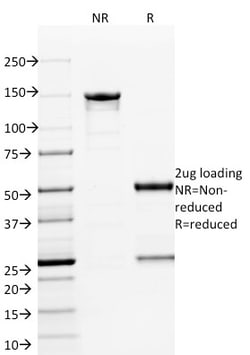 Biotium&nbsp;ETS1 (Marker of Tumor Metastasis)(ETS1/1801), CF568 conjugate, 0.1mg/mL
