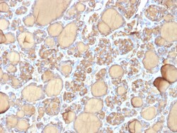 Biotium&nbsp;Thyroglobulin (Thyroidal Cell Marker) (r6E1), CF647 conjugate, 0.1mg/mL