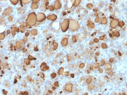 Biotium&nbsp;Thyroglobulin (Thyroidal Cell Marker) (rTGB24), CF647 conjugate, 0.1mg/mL