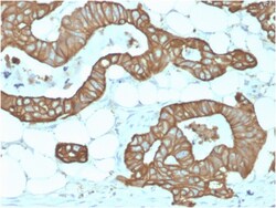 Biotium&nbsp;Cytokeratin 19 (KRT19) (Pancreatic Stem Cell Marker) (KRT19/1959R), CF647 conjugate, 0.1mg/mL