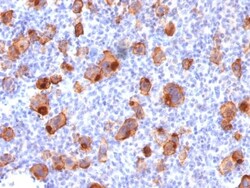 Biotium&nbsp;CD30 / TNFRSF8 (Hodgkin & Reed-Sternberg Cell Marker) (rKi-1/779), CF568 conjugate, 0.1mg/mL