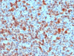 Biotium&nbsp;S100B (Astrocyte and Melanoma Marker), CF594 conjugate, 0.1mg/mL