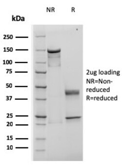 Biotium&nbsp;TIMP1 (Colorectal Cancer Biomarker / Marker of Lymph Node Metastasis)(rTIMP1/1710), CF594 conjugate, 0.1mg/mL