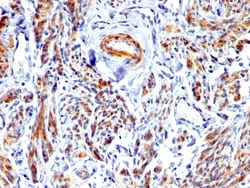 Biotium&nbsp;Caldesmon, HMW (h-Caldesmon) (Smooth Muscle Marker), CF488A conjugate, 0.1mg/mL