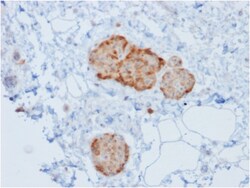 Biotium&nbsp;Chromogranin A / CHGA (Neuroendocrine Marker)(rCHGA/777), CF647 conjugate, 0.1mg/mL