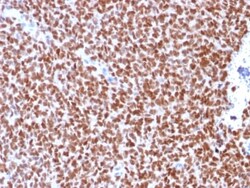 Biotium&nbsp;NKX2.2 (Neuroendocrine & Ewing s Sarcoma Marker) (rNX2/294), Biotin conjugate, 0.1mg/mL