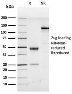 Biotium&nbsp;Human Herpes Virus 8 (HHV8)(LN53), CF594 conjugate, 0.1mg/mL